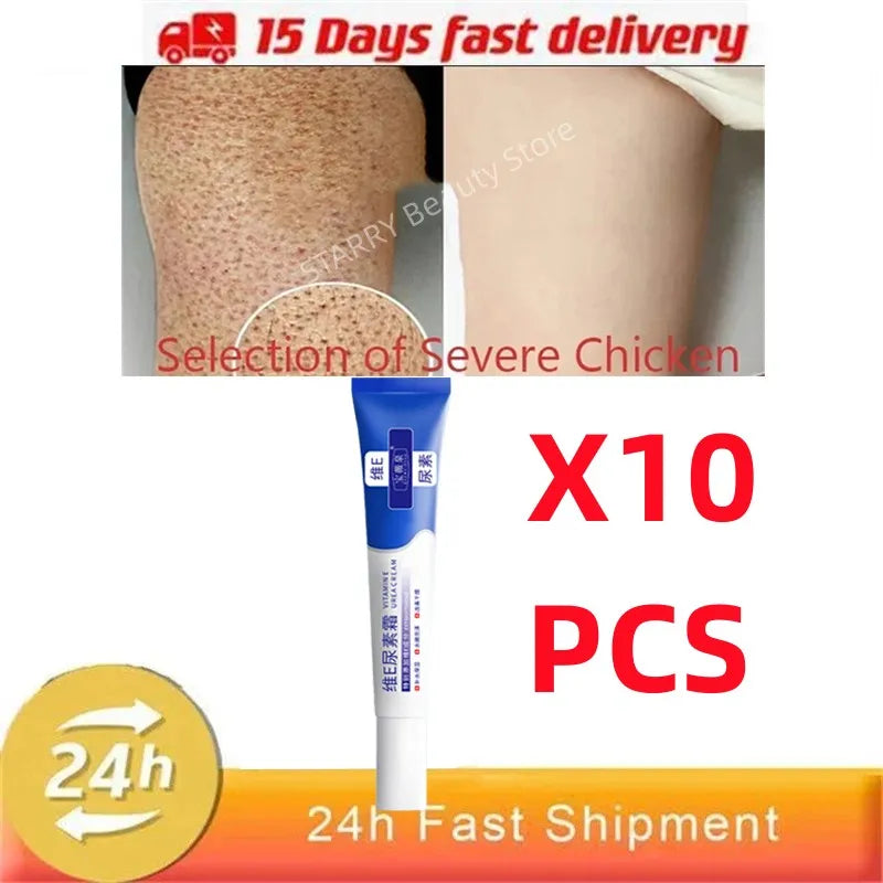Curing Keratosis Pilaris Chicken Follicle Skin Repair Cream Body Dark Spot Remove Whitening Smooth Moisturize Skincare Body loti