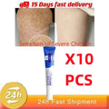 Curing Keratosis Pilaris Chicken Follicle Skin Repair Cream Body Dark Spot Remove Whitening Smooth Moisturize Skincare Body loti
