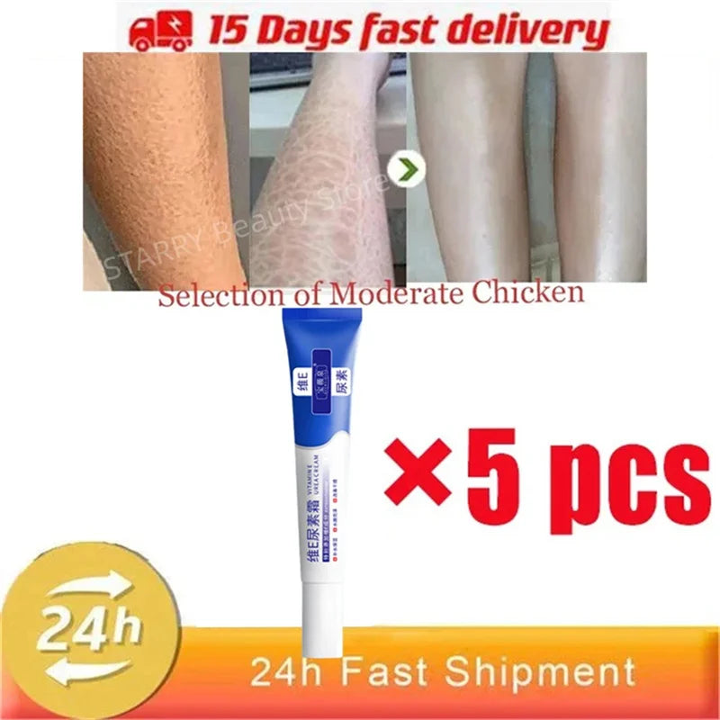 Curing Keratosis Pilaris Chicken Follicle Skin Repair Cream Body Dark Spot Remove Whitening Smooth Moisturize Skincare Body loti