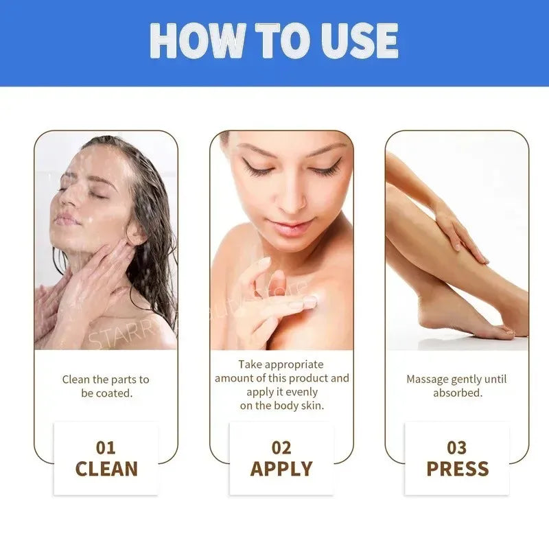 Curing Keratosis Pilaris Chicken Follicle Skin Repair Cream Body Dark Spot Remove Whitening Smooth Moisturize Skincare Body loti